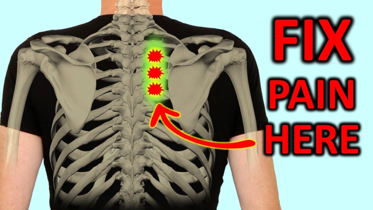 "rhomboid Pain": How To Fix Shoulder Blade Pain Quickly