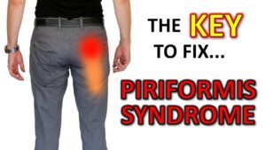 The Key To Fix Piriformis Syndrome … For Good (don’t