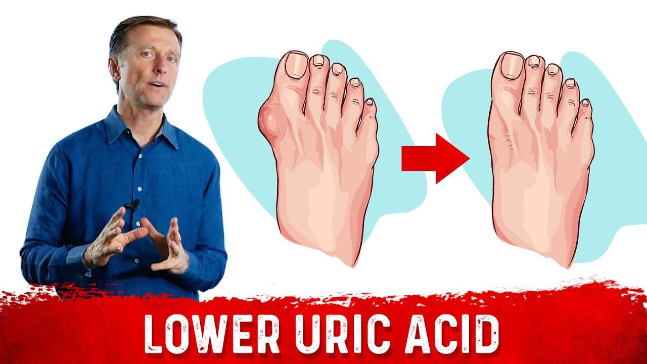 Ways to Neutralize Uric Acid