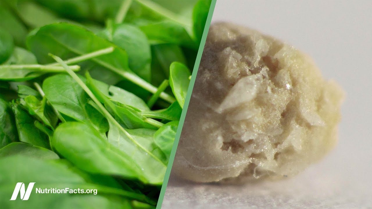 Oxalates in Spinach and Kidney Stones Should We Be Concerned?