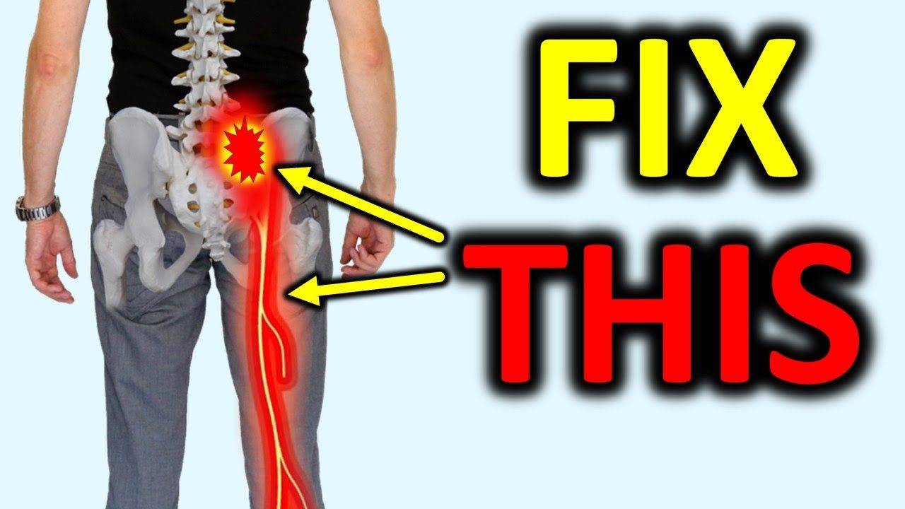 Instant Sciatica Pain Relief with Easy Exercises