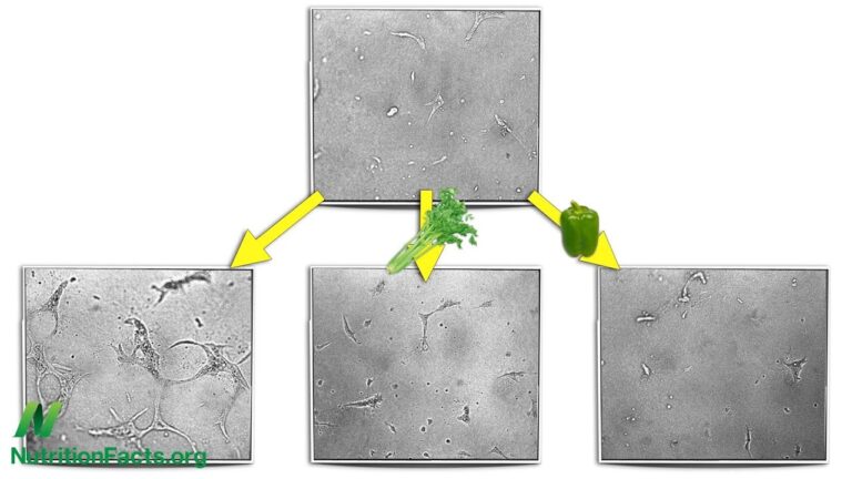 Anti Angiogenesis: Cutting Off Tumor Supply Lines